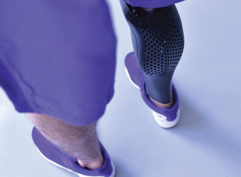 3D printed prosthetic leg cover