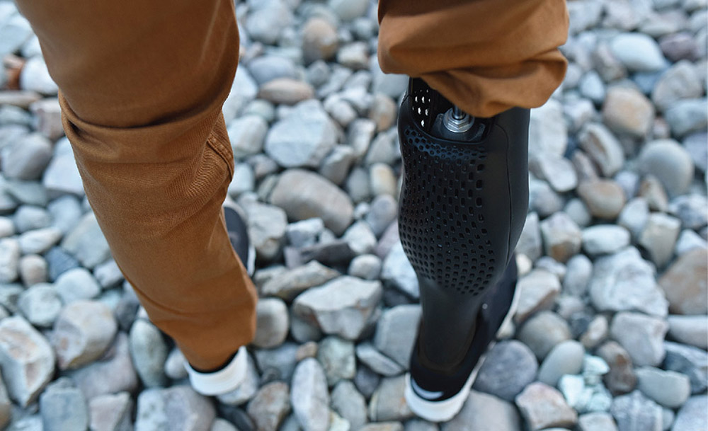 3D printed prosthetic leg cover