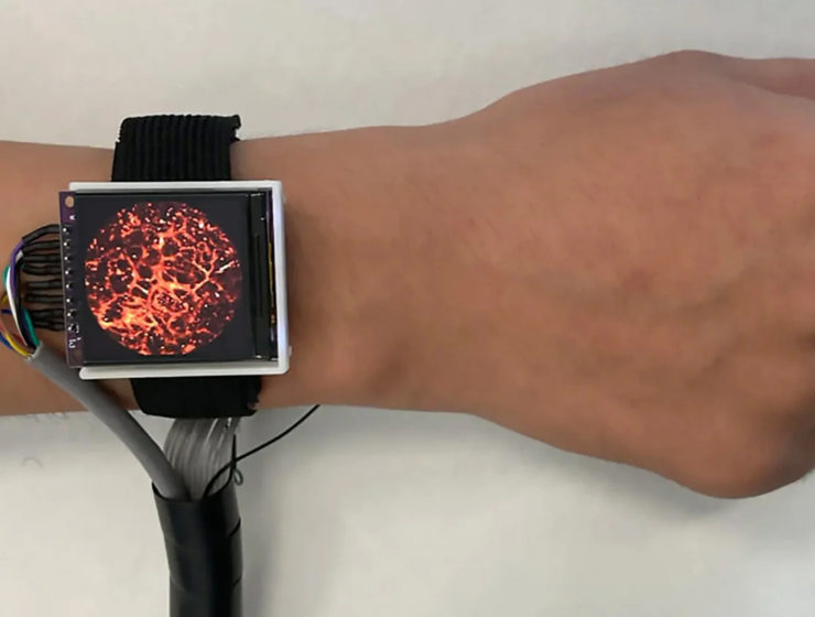 Photoacoustic Imaging Watch